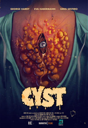 Cyst affiche film