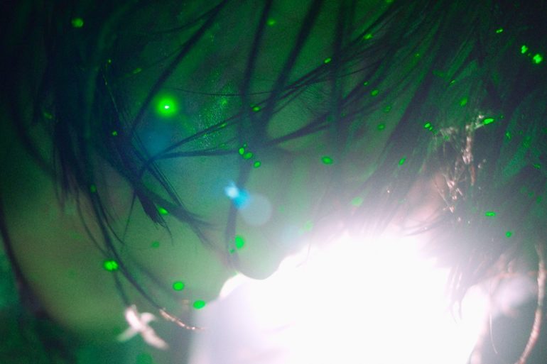 fifth thoracic vertbrae main stills 5